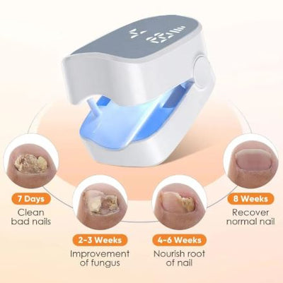 Kler — Dual-Light Nail Renewal Device