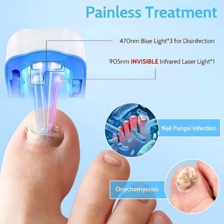 Kler — Dual-Light Nail Renewal Device